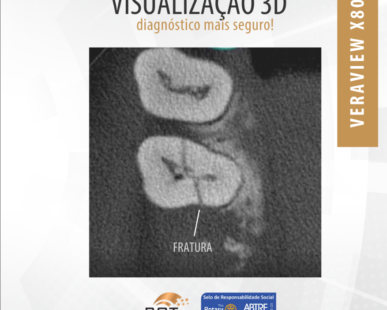 visualizacao-3d