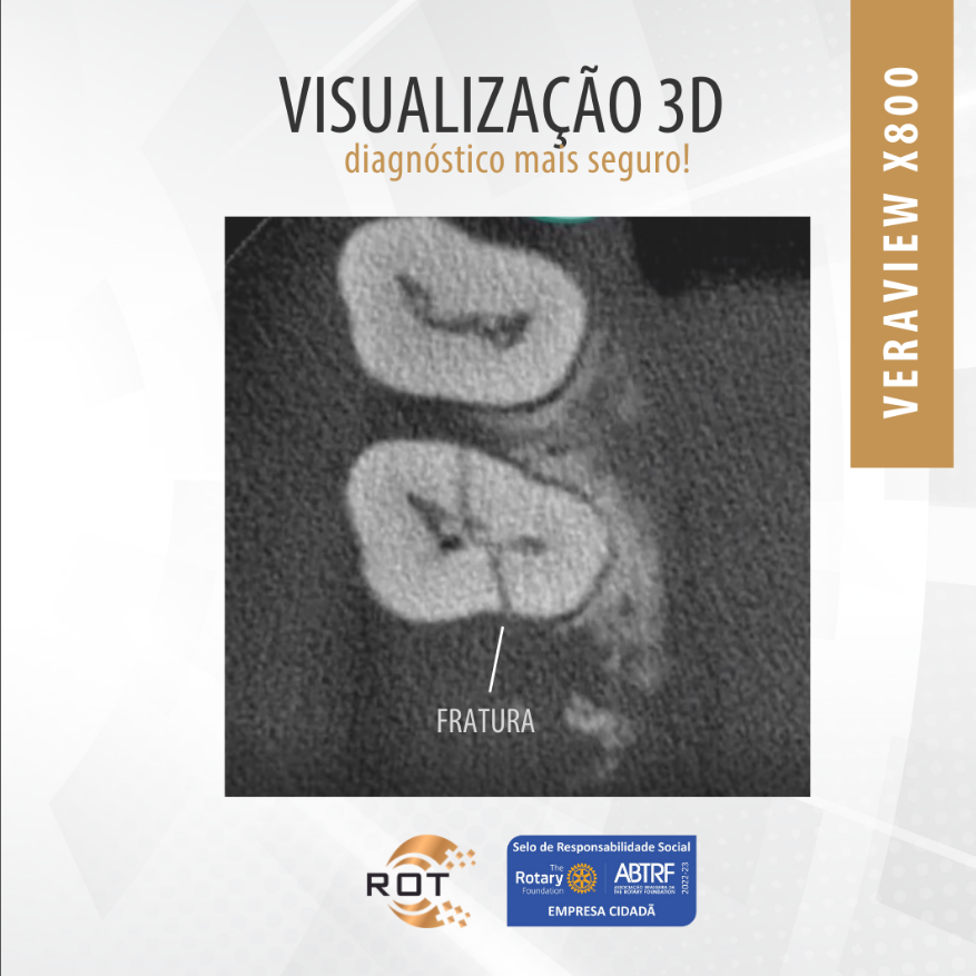 visualizacao-3d