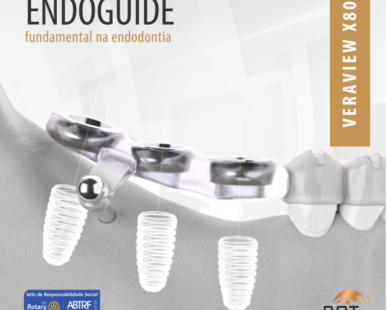 endoguide