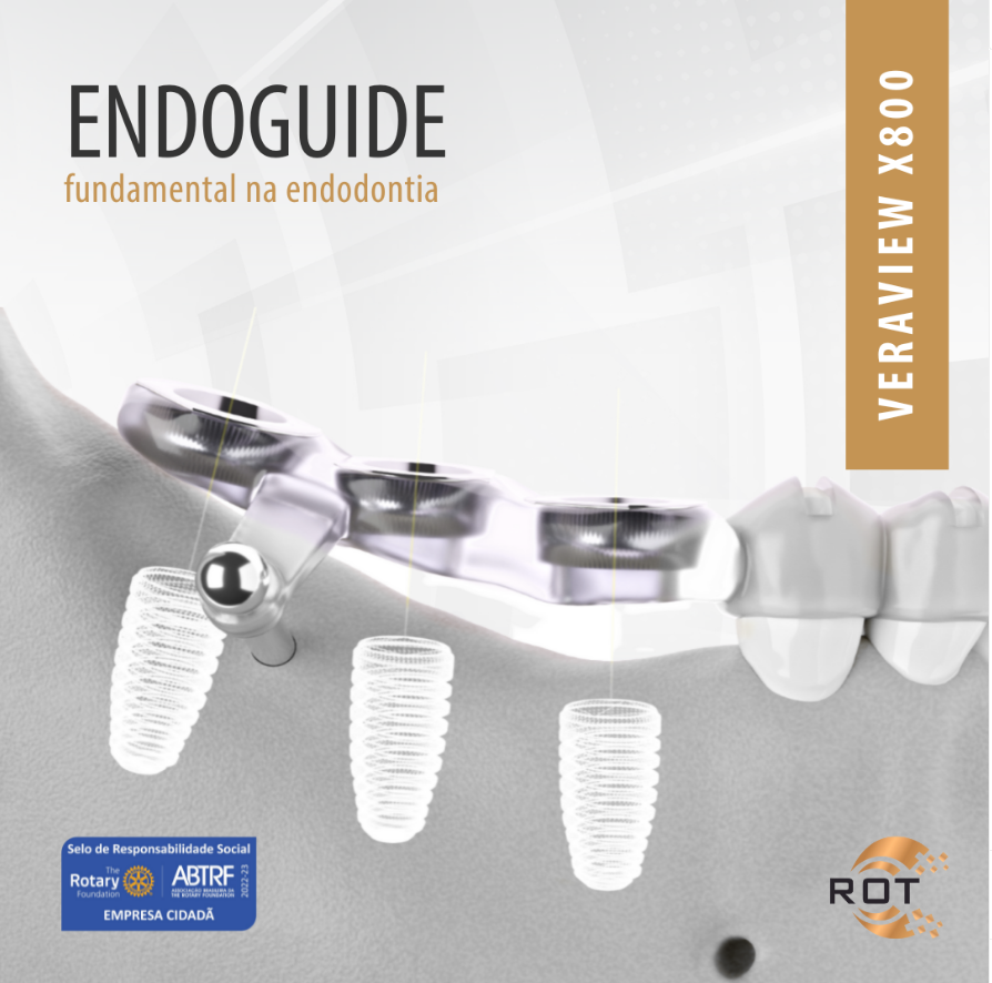 endoguide