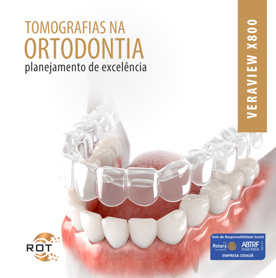 tomografias-na-ortodontia