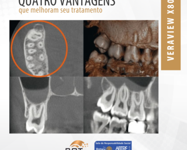 quatro-vantagens-que-melhoram-seu-tratamento