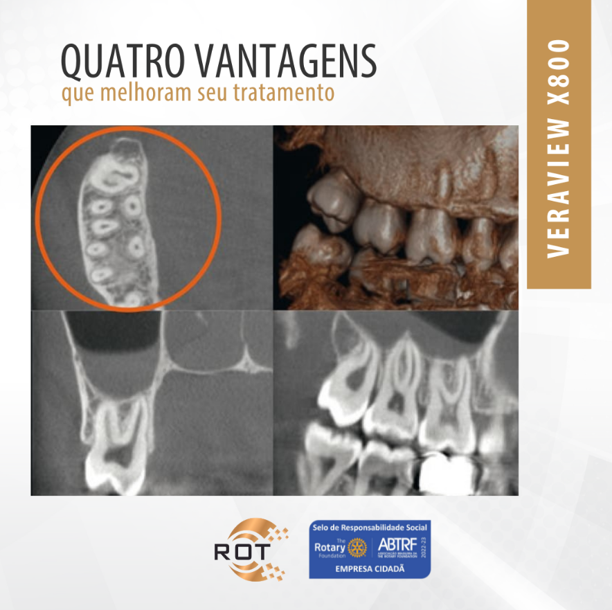 quatro-vantagens-que-melhoram-seu-tratamento