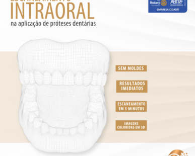 escaneamento-intraoral