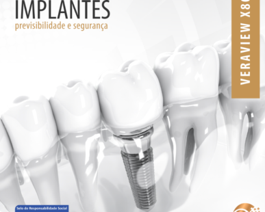 implantes