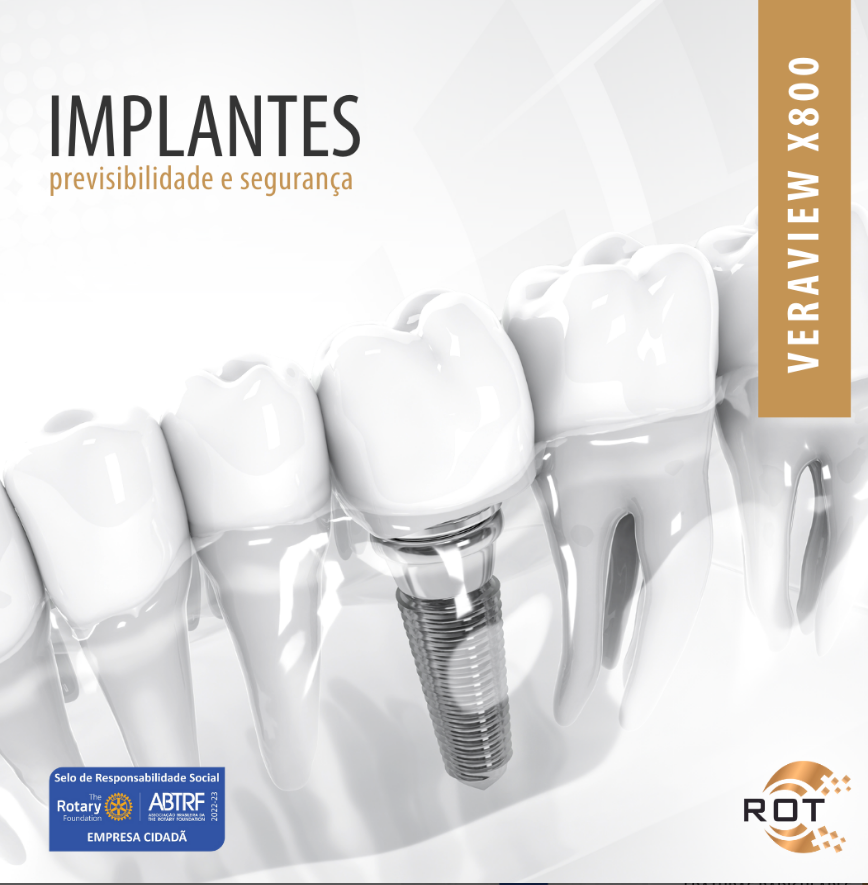 implantes