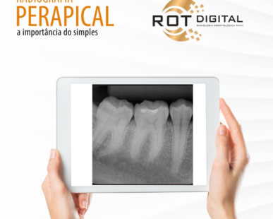 radiografia-perapical