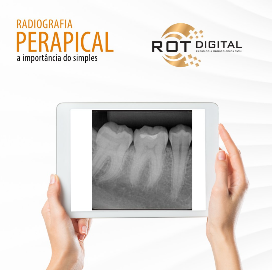 radiografia-perapical