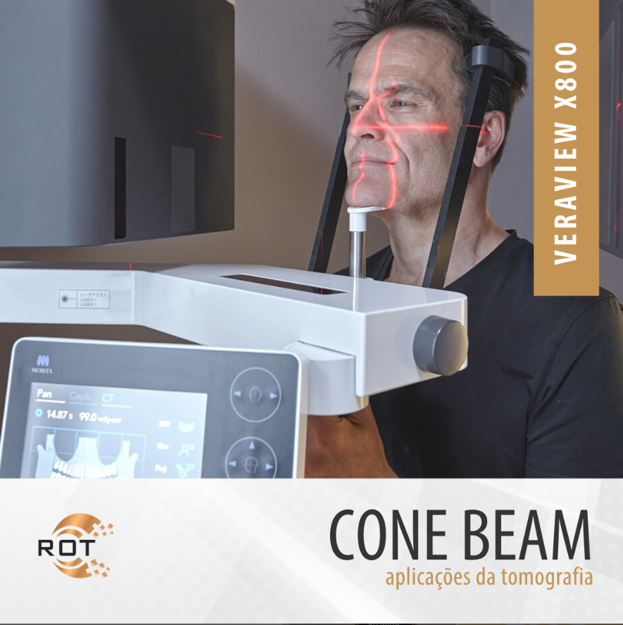 cone-beam