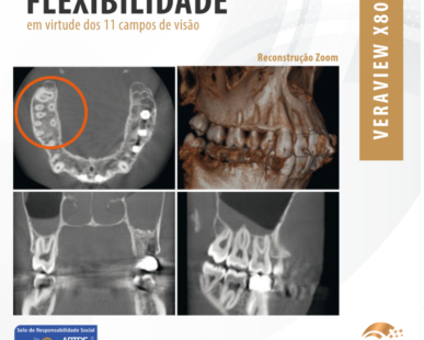 flexibilidade-em-virtude-dos-11-campos-de-visao