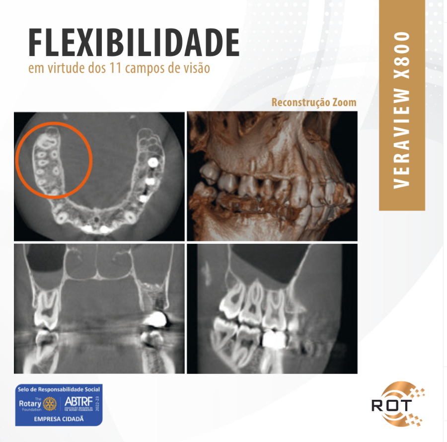 flexibilidade-em-virtude-dos-11-campos-de-visao