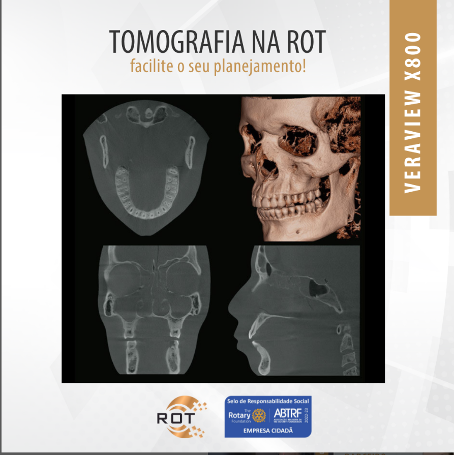 tomografia-na-rot