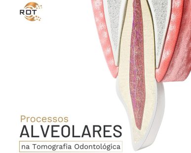 processos-alveolares