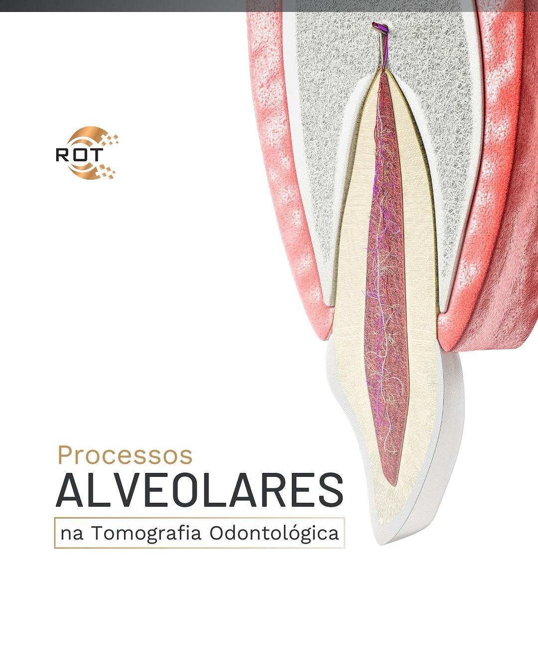 processos-alveolares