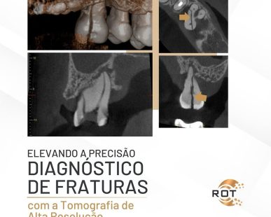 diagnostico-de-fraturas