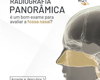 a-radiografia-panoramica