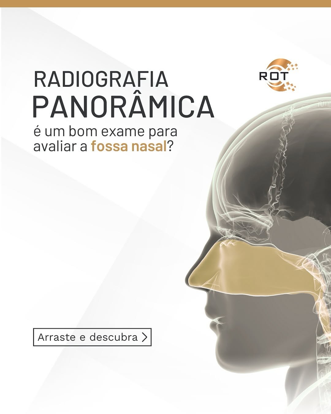 a-radiografia-panoramica