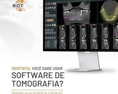 software-de-tomografia