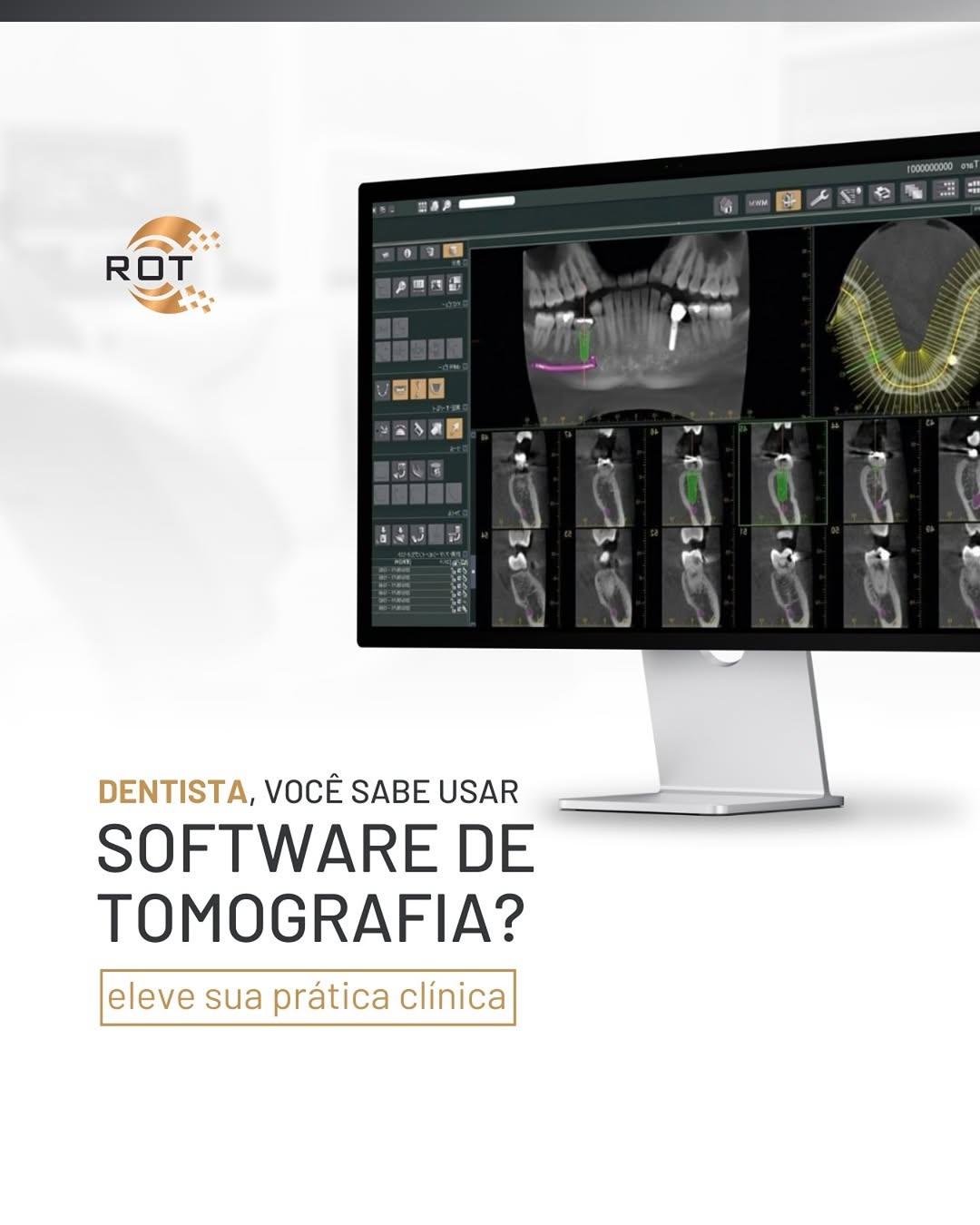 software-de-tomografia