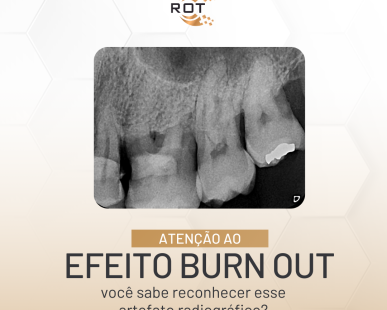 efeito-burn-out