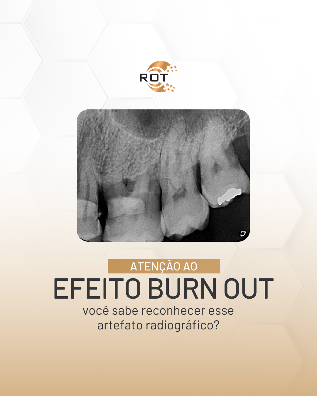 efeito-burn-out