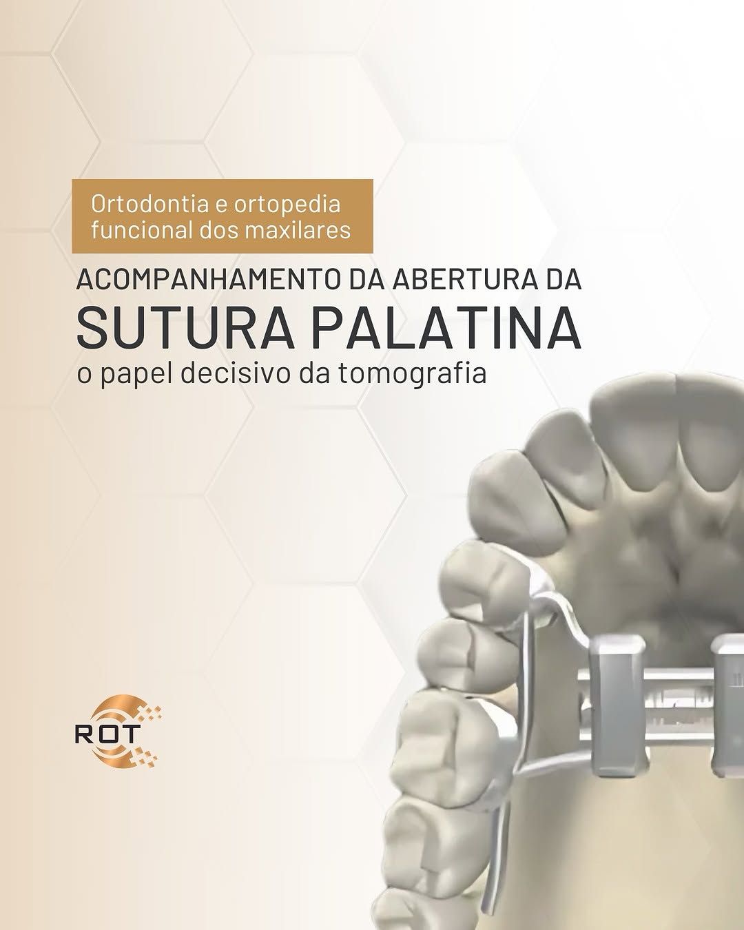 acompanhamento-da-abertura-da-sutura-palatina